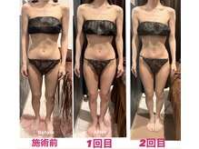 アクワレル ゆりまち袖ケ浦駅前モール店(aquarelle)/スリムムーブ×2回コース
