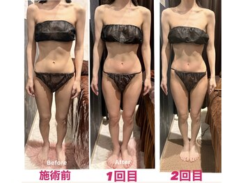 アクワレル ゆりまち袖ケ浦駅前モール店(aquarelle)/スリムムーブ×2回コース