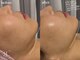 シャリル(charire)の写真