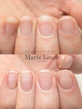 マリーロール 淀屋橋本店(Marie Laure)/自爪育成/深爪矯正/ネイルケア