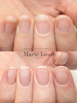 マリーロール 淀屋橋本店(Marie Laure)/自爪育成/深爪矯正/ネイルケア