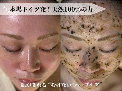 ルミア(LUMIA)の写真