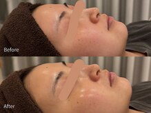 アウラ 小杉店(AULA)/