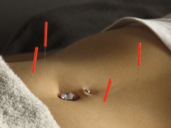 ビーネ 秋田(Beene)/痩身鍼灸施術