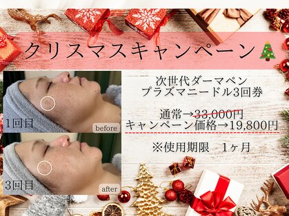 ライリー(Rairy)の写真