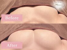 ロココ つくば店(Rococo)/BEFORE/AFTER