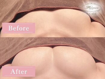 ロココ つくば店(Rococo)/BEFORE/AFTER