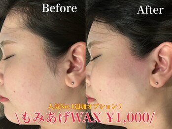 ジョエルワックス 沖縄那覇店(JOELLE WAX)/気になる一部分でも脱毛可能です