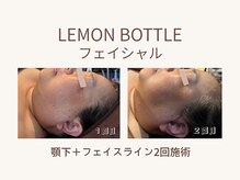 ビーモア(B.MORE)/重ねるほど美しいライン