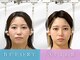 エルシンメトリー矯正院(ailesシンメトリー矯正院)の写真