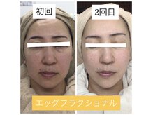 アウレア 辻堂(aulea)/エッグフラクショナル