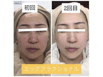 アウレア 辻堂(aulea)/エッグフラクショナル