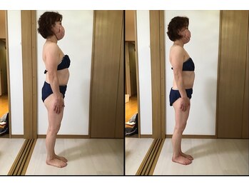 サロン シエラ/施術1回　50代