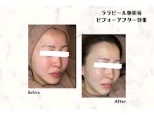 サロン ド マハロ(Salon de MAHALO)/<フェイシャルエステ>