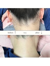 シュガーリングハウスレディ(SugaringHouse LADY)/圧倒的な”美うなじ”へ