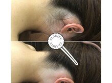 クラリティー 阿佐ヶ谷店(CLARITY)の雰囲気（大人気のうなじ脱毛◎美容院で剃られてしまう方やまとめ髪にも◎）