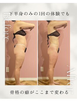 ティーサロン 石神井公園店(T SALON)/セルライトゼロ２下半身１回体験