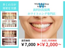 ホワイトニングショップ 春日井店(whitening shop)