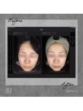 ゴーマルイチ(501)&nbsp;人気NO.1 肌管理