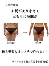 サロンあえる 新大宮店/後ろ姿美人はエステで作れます！