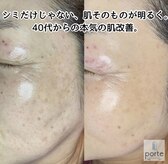 40代からのシミケア.痩身専門サロン　porte by Harmo【3/17 NEW OPEN（予定）】 