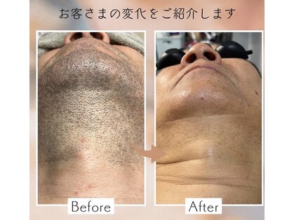 アナハタビューティーサロン(aNahata beauty salon)の写真