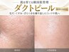 【毛穴レス・くすみ・乾燥】韓国肌管理ダクトピール＋超音波毛穴洗浄