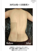 カナエル(QANAEL)/スリミングクリーム効果5