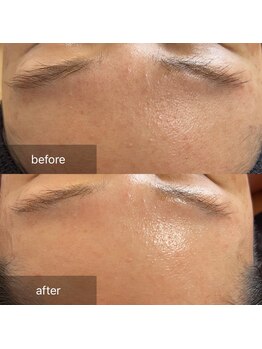 ナウ(now)/『陶肌トリートメント』