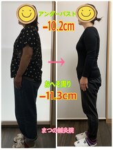 まつの鍼灸院/11.7キロ痩せて身体の厚みが薄く