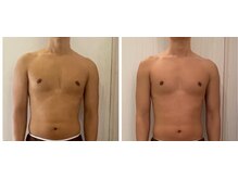 トラ 恵比寿店(TORA)/【トレーニング後の筋膜ケア】