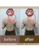 めぐりねこ/リンパ/痩身/小顔/たるみケア