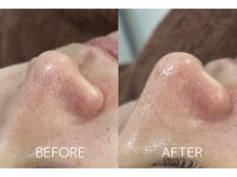 ラポール 野並店(Rapport)/