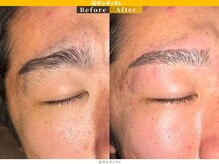 眉ダンディズム 大阪天神橋六丁目店/ナチュラル眉毛before/after