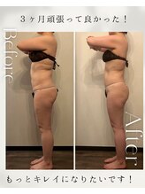 ティーサロン 石神井公園店(T SALON)/セルライトゼロ２　全身１０回