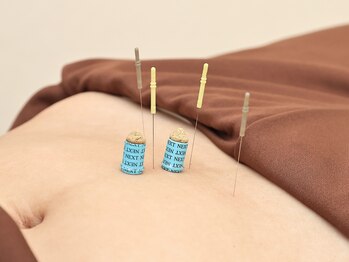 柚香鍼灸院/施術風景　妊活鍼灸　婦人科鍼灸