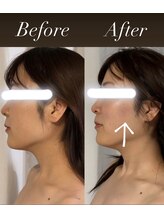 サロンドベベ(salon de Bebe.)/お客様ビフォーアフター