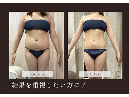 アディッシモ(addissimo)の写真