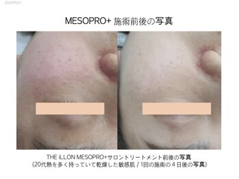 アルメ(Alume)/触れたくなる肌に♪