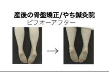 やち鍼灸院/産後の骨盤矯正で元気に！