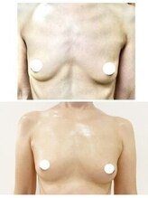 美人バスト 札幌店/バストアップ×育乳◇症例◇