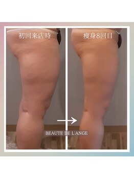 ボーテ ドゥ ランジュ(BEAUTE DE L’ANGE.)/◆痩身◆