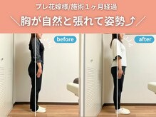 整体院カイト/【20代ブライダル】before/after
