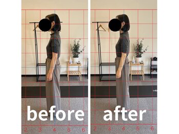 カワル整体 長嶺院/猫背