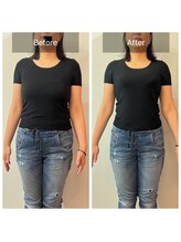 ティーサロン 石神井公園店(T SALON)/苦しくない！補正下着の効果