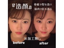 小顔にするのは当たり前！歪みの改善から大きくならない顔造り