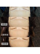 トゥインクル(Twinkle)/額の線も…