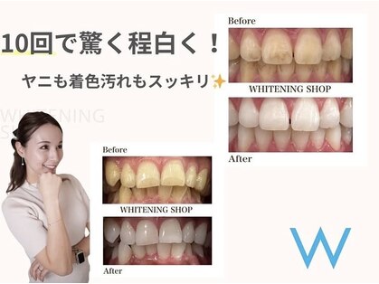 ホワイトニングショップ 池田店の写真