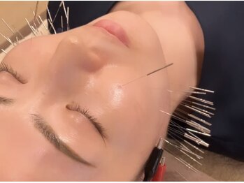 オリエンタル ルボワール(oriental Revoir)/顔鍼　美顔鍼　美容鍼灸