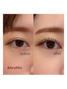 リンダ(LINDA)の写真/〈&Healthy〉導入/マツエク+パーマの同時施術でお悩み解決&理想の目元を実現♪初めての方や学生さんにも◎